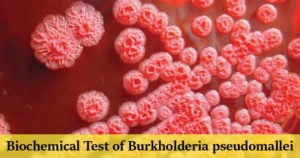 Burkholderia pseudomallei的生化试验