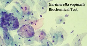 Gardnerella Vaginalis的生化试验
