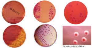 Yersinia Selective Agar