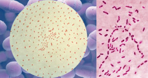 百日咳波德氏杆菌的生化检验