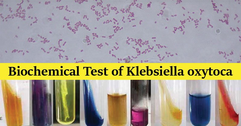 Klebsiella oxytoca的生化试验