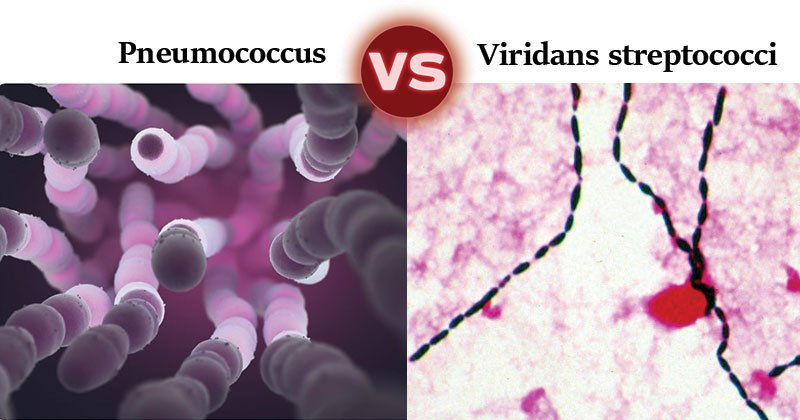 肺炎球菌和viridans链球菌之间的差异