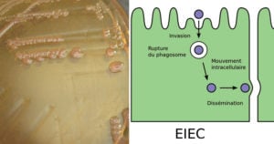 estoInvasive大肠杆菌（EIEC）