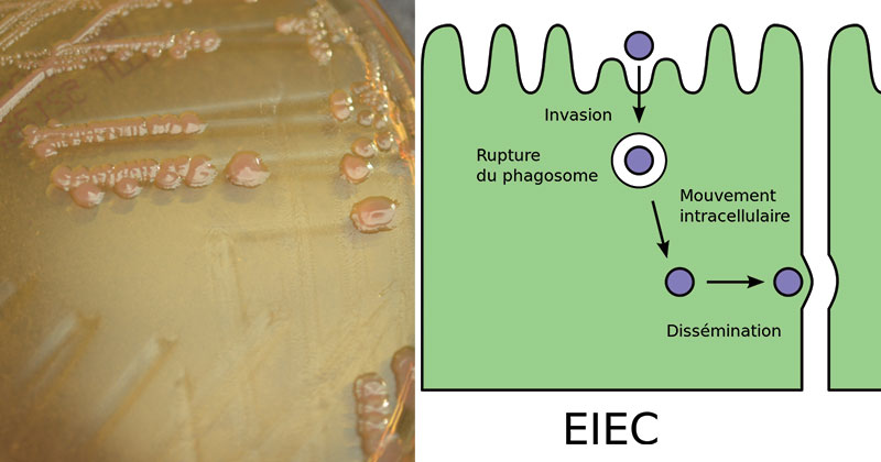 肠侵入性大肠杆菌(EIEC)