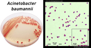 鲍曼不动杆菌-实验室诊断，治疗和预防