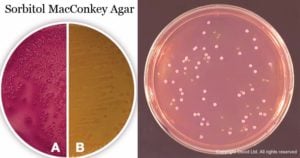 山梨糖醇Macconkey Agar.