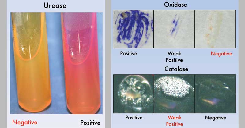土拉伦弗朗西斯菌的生化检测
