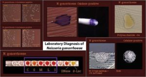 淋病奈瑟氏菌 - 实验室诊断，治疗，预防