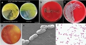 Burkholderia cepacia的生化测试