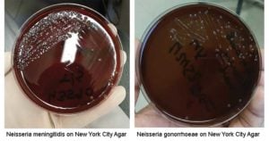 New York City Agar