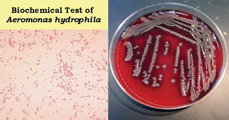 嗜水气单胞菌的生化检验
