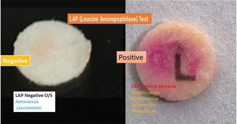 亮氨酸氨基肽酶(LAP)试验