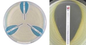 Epsilometer test (E test)