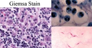 Giemsa Stain- Principle, Procedure, Results, Interpretation