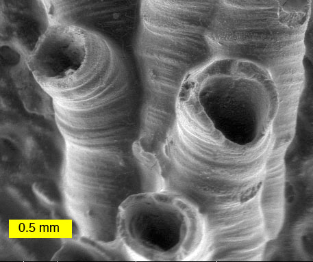 密歇根泥盆纪的hederelloid的扫描电子显微镜图像(最大的管直径0.75毫米)。