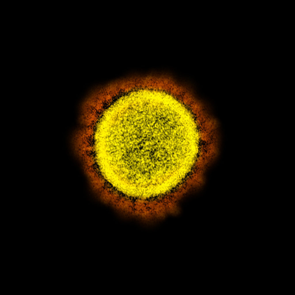 15. SARS-COV-2的透射电子显微照片