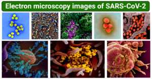 SARS-COV-2的电子显微镜图像