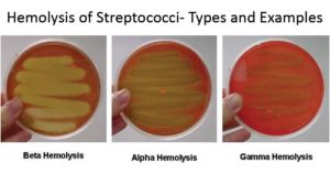 链球菌的溶血和图像的例子
