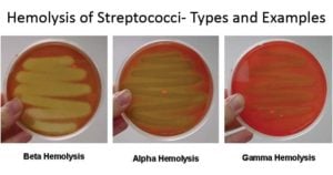 链球菌的溶血-类型和例子配图
