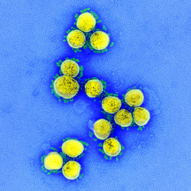 SARS-CoV的-2病毒颗粒的透射电子显微照片