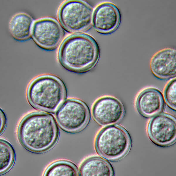 皮炎芽生菌酵母在37℃的血液琼脂上培养，并在Nomarski微分干涉对比显微镜下拍照。