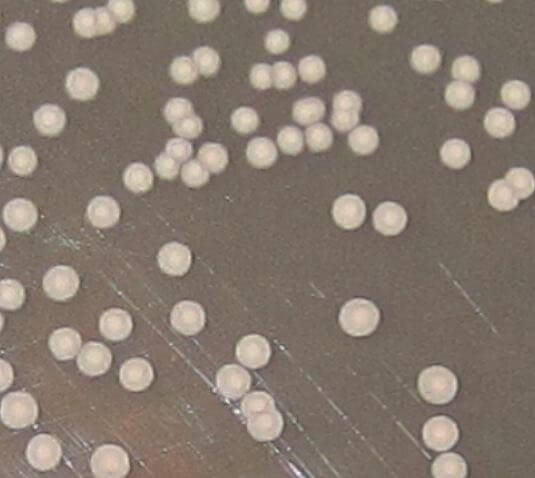 假丝酵母菌旁凸- Hicrome琼脂上的粉红色菌落