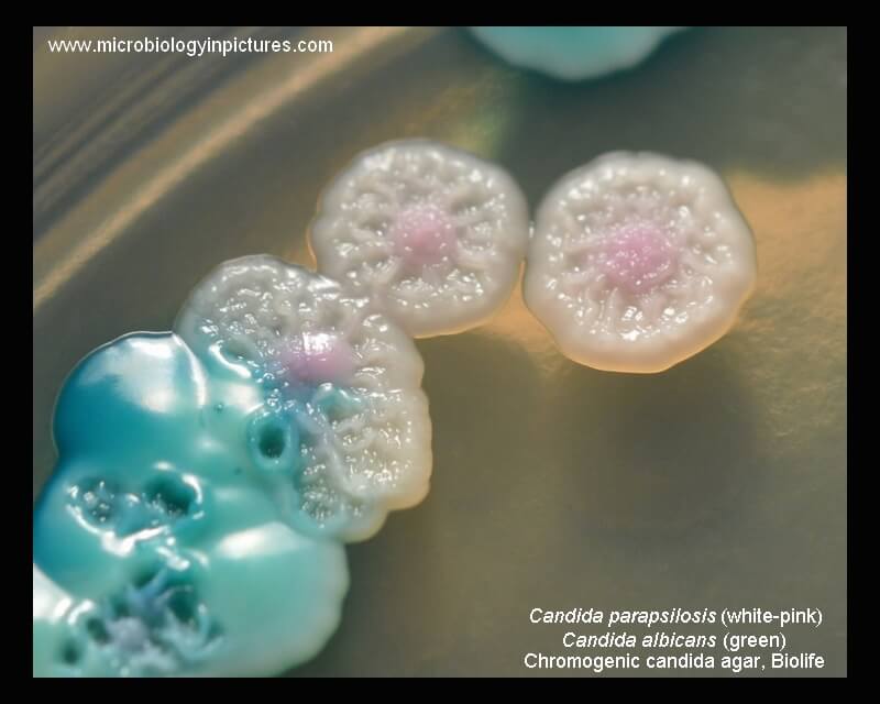 显色念珠菌琼脂上的副扁平假丝酵母菌和白色念珠菌菌落