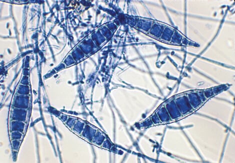 犬小孢子菌的大分生孢子