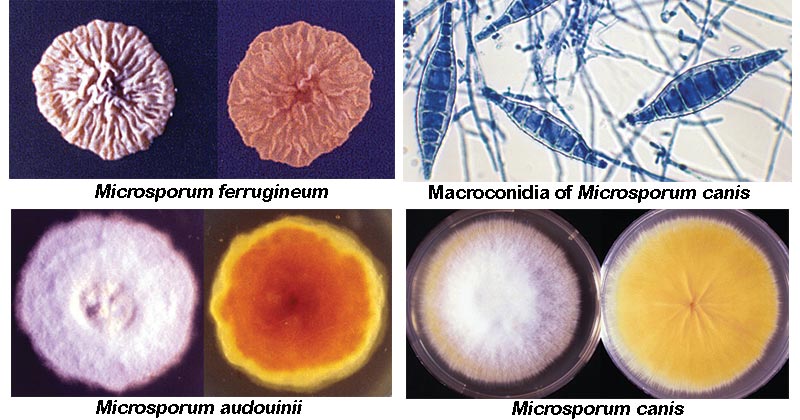 Microsporum spp