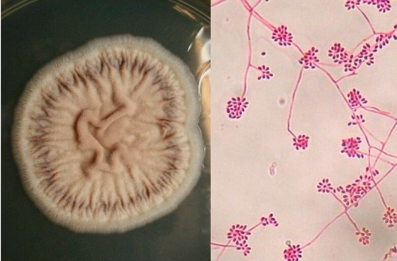 申氏孢子丝菌的培养特性