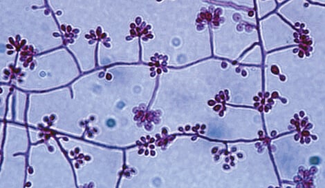 申氏孢子丝菌分生孢子和分生孢子