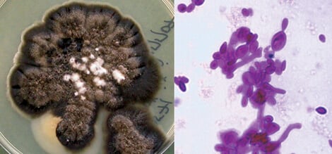 申氏孢子丝菌培养