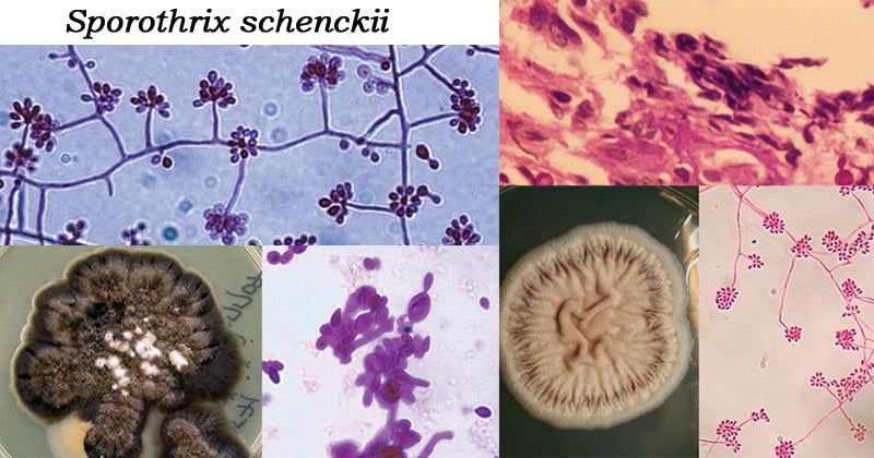 孢子丝菌schenckii