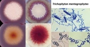 Trichophyton宫颈胶质细胞
