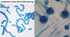 乳酚棉蓝（LPCB）染色