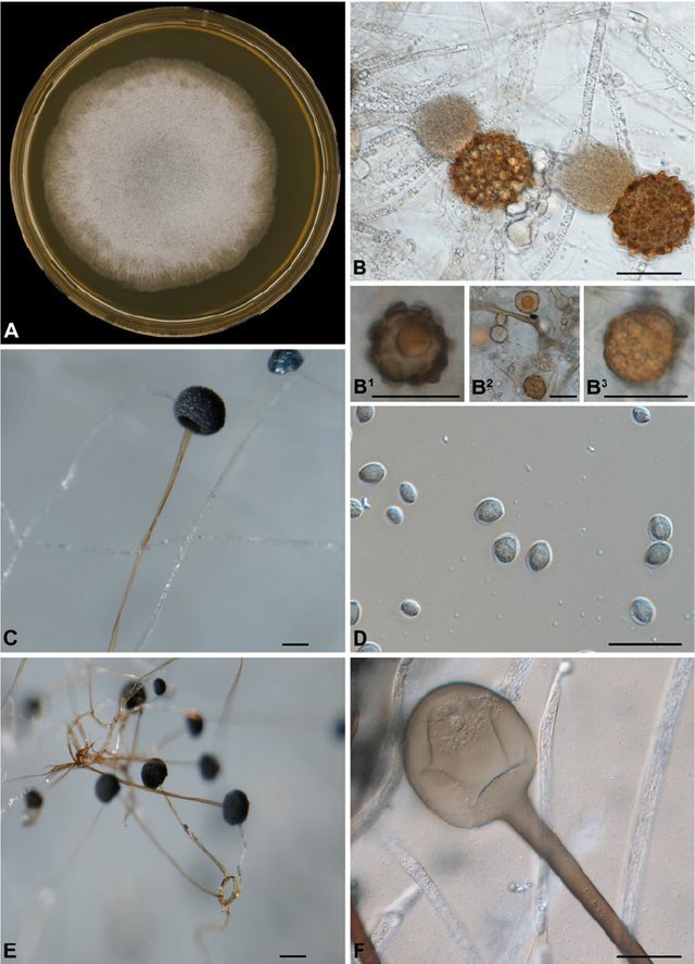 小孢子根霉的宏观和微观形态