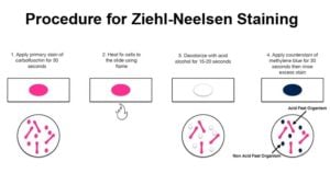 Ziehl-neelsen染色的程序