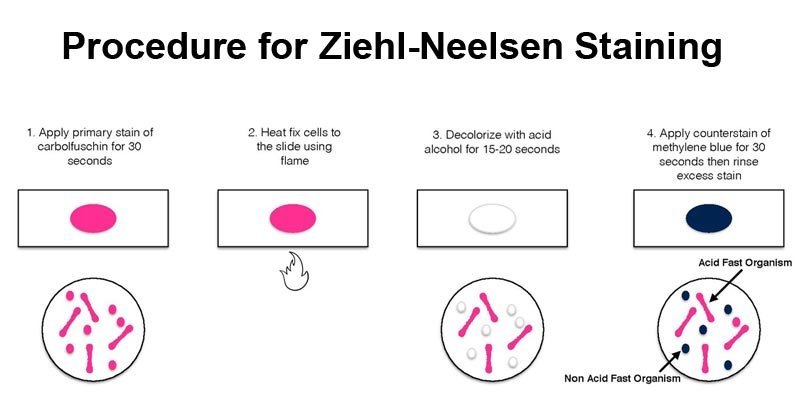 Ziehl-Neelsen染色程序