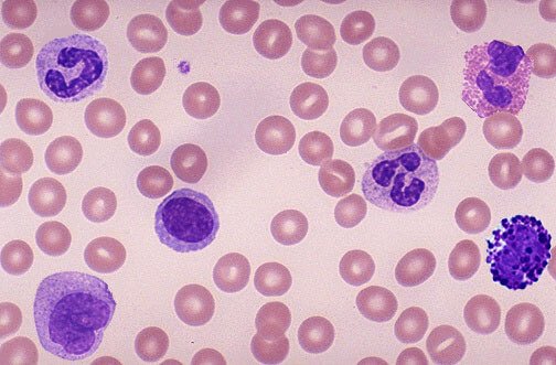 显微镜下的血细胞