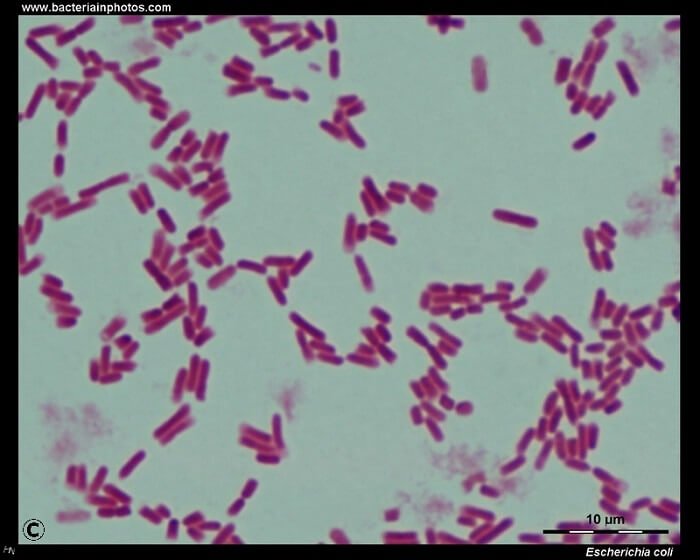 在显微镜下观察大肠杆菌