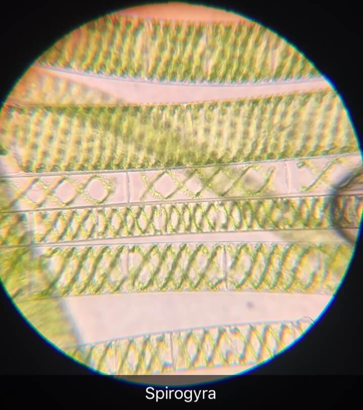 Spirogyra在显微镜下