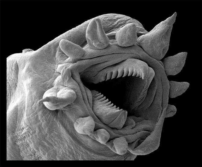 显微镜下的蠕虫