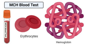 MCH血液测试
