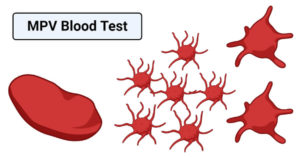 MPV血液测试