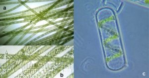 Spirogyra的形态