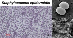 葡萄球菌epidermidis  - 概述