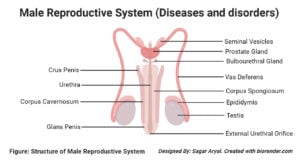 男性生殖系统的疾病和紊乱