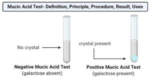 Mucic Acid Test- Definition, Principle, Procedure, Result, Uses