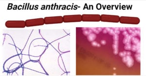 Bacillus anthracis