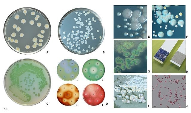 铜绿假单胞菌的生化特性